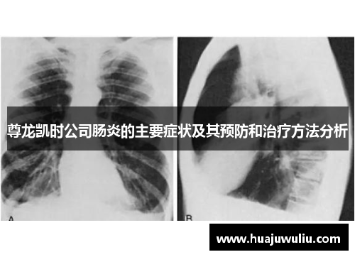 尊龙凯时公司肠炎的主要症状及其预防和治疗方法分析